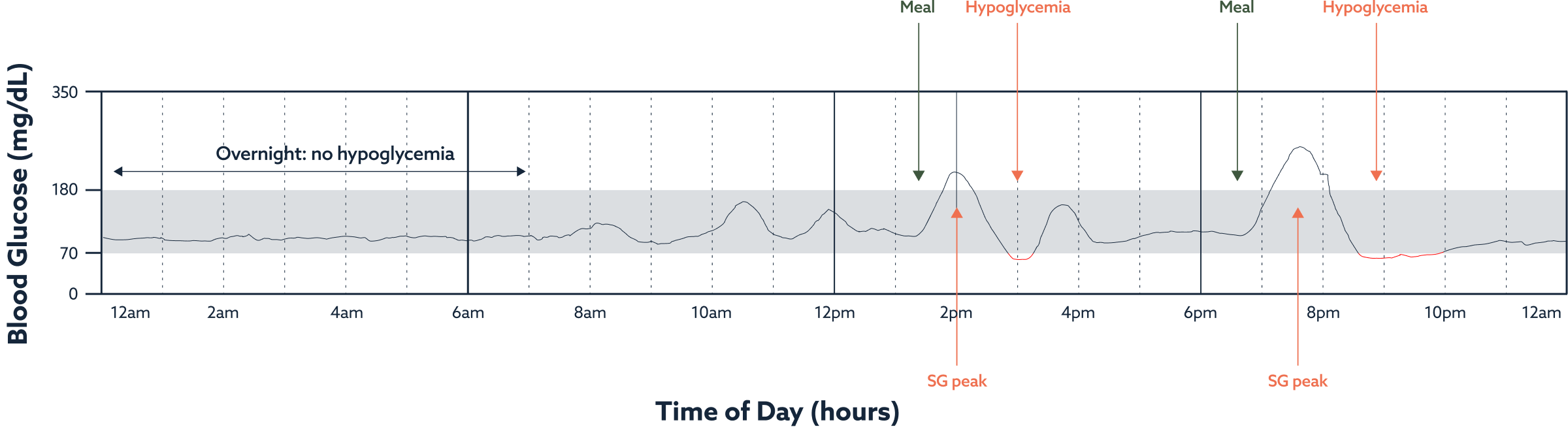 Representative CGM graph showing blood glucose levels over time