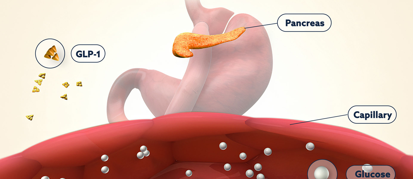 Explore the Underlying Pathophysiology