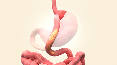 Illustration showing nutrients moving rapidly through the small intestine