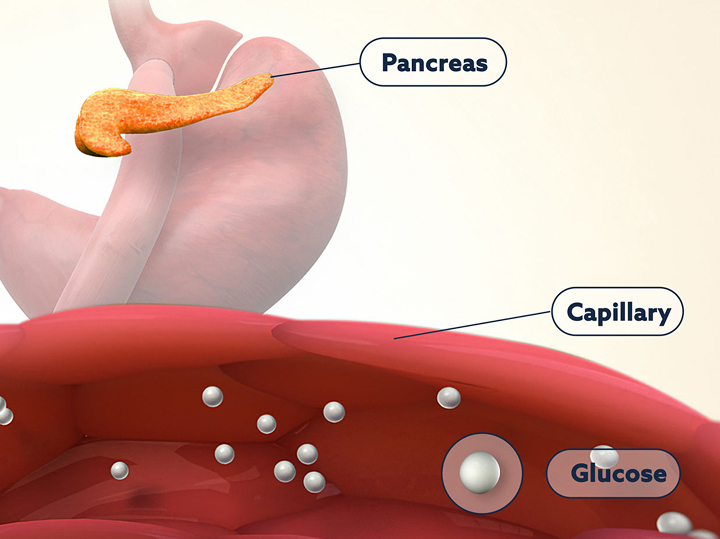 Explore the Underlying Pathophysiology
