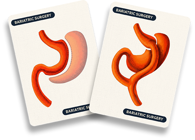 Illustration of stomach anatomy cards
